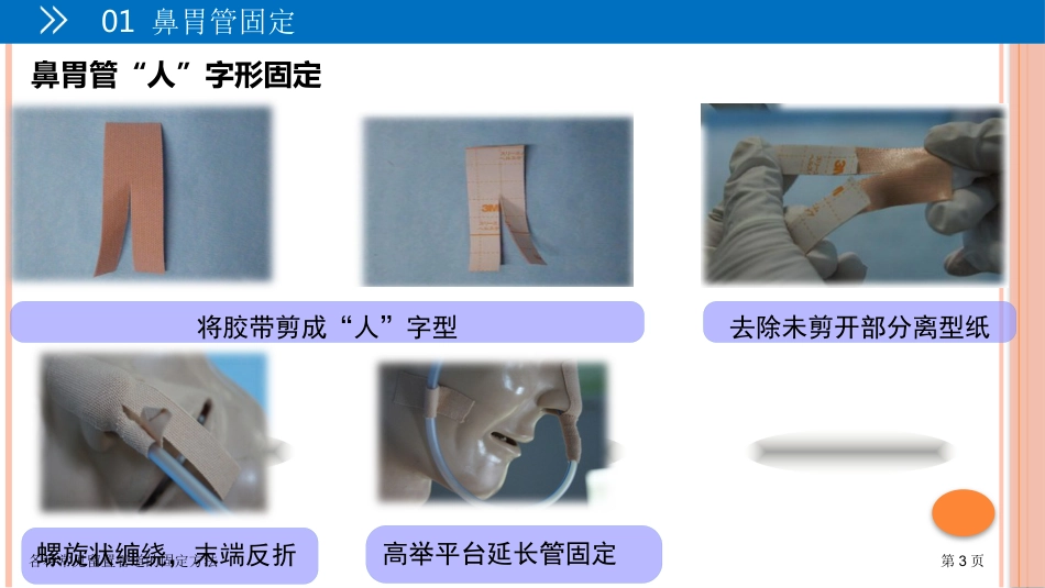 各种常见留置管道的固定方法_第3页