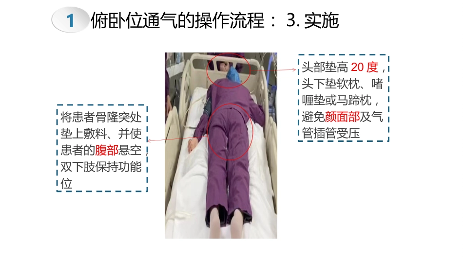 俯卧位通气的操作流程及护理要点_第12页