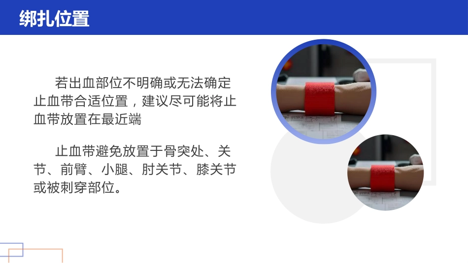护理小讲课——正确管理与使用止血带_第12页