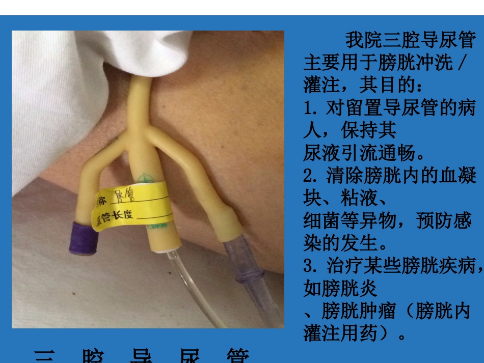 留置管道管理_第10页