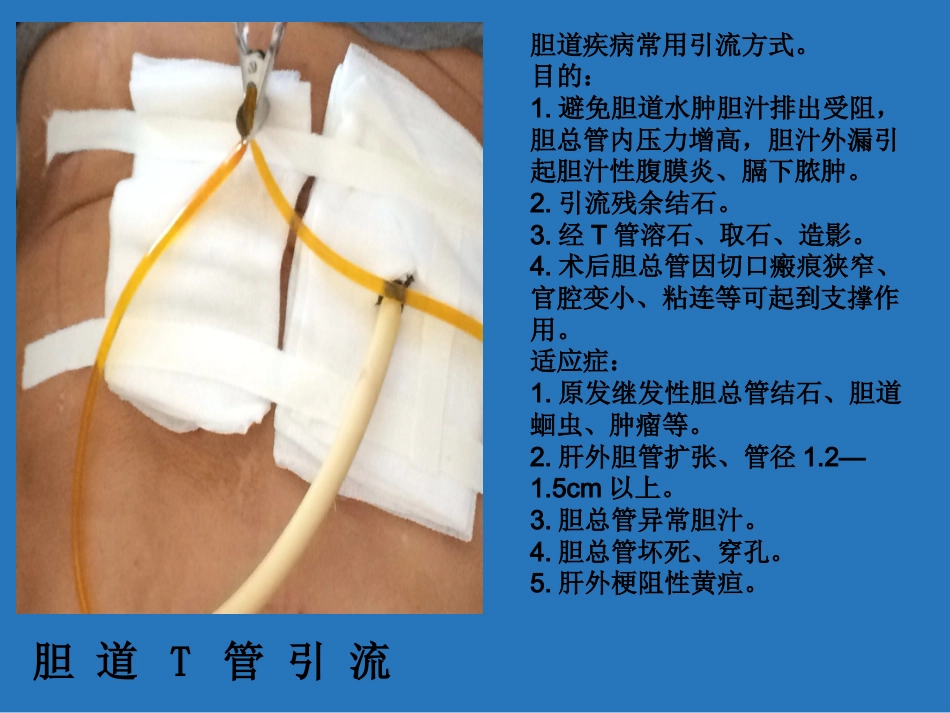 留置管道管理_第14页
