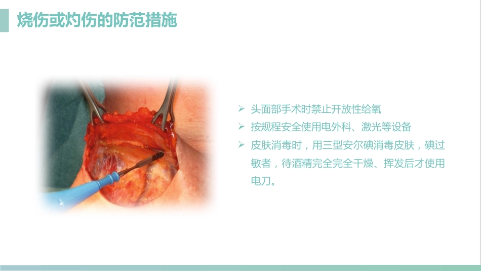 护理管理：手术室的护理安全管理课件_第11页
