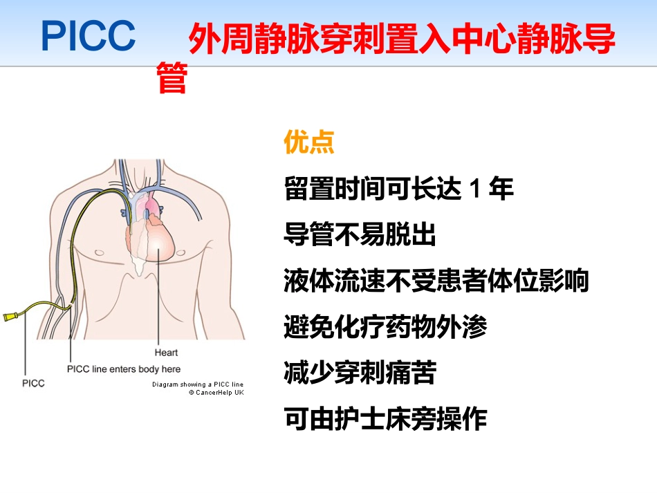 picc导管规范化维护_第2页
