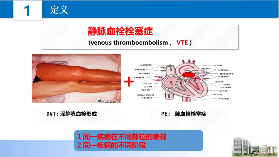 院内VTE控制管理_第6页