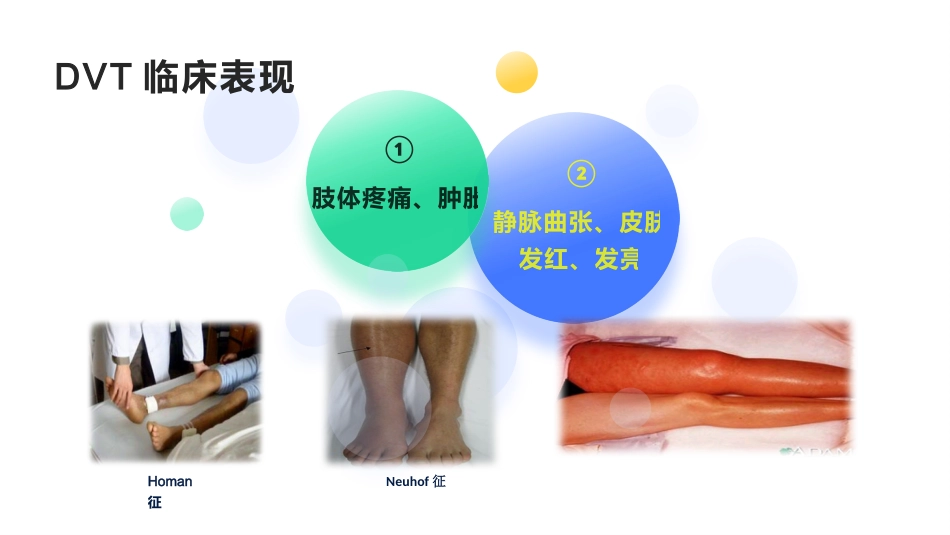 院内VTE的预防及护理措施_第5页