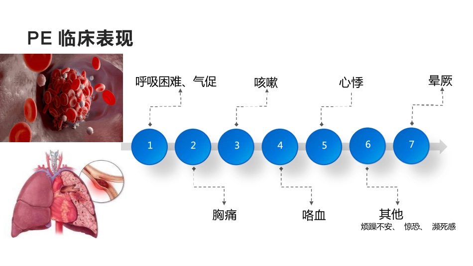 院内VTE的预防及护理措施_第6页