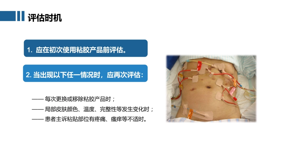 2025成人患者医用粘胶相关性皮肤损伤的预防及护理团体标准ppt_第14页