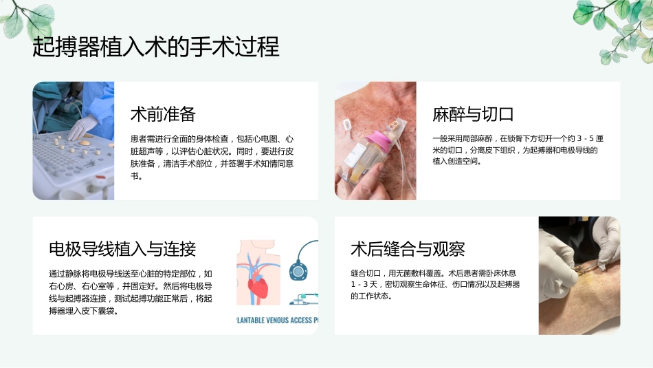 起搏器植入术后护理常规ppt_第8页
