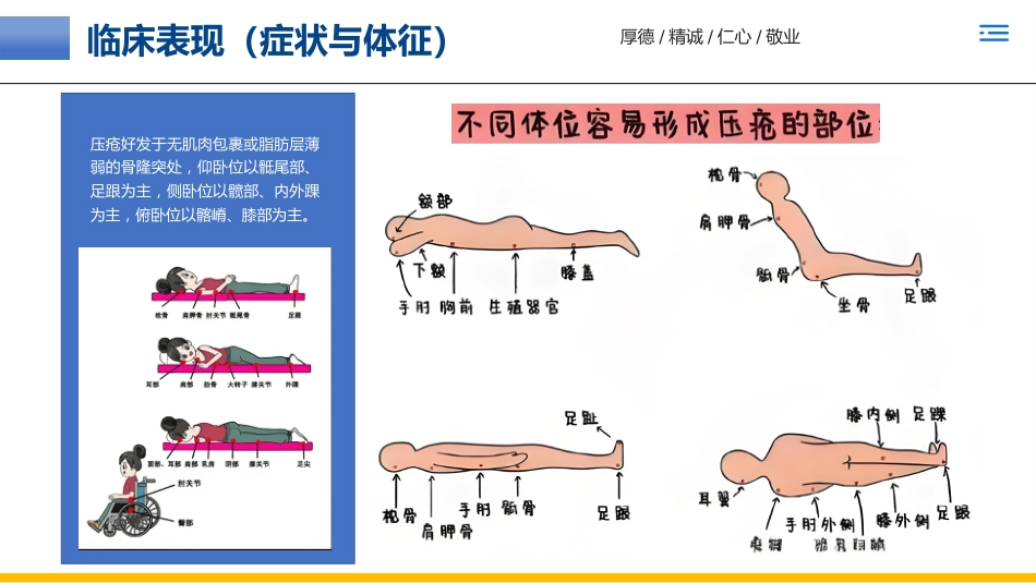 一例褥疮(压力性损伤)患者的个案护理_第9页