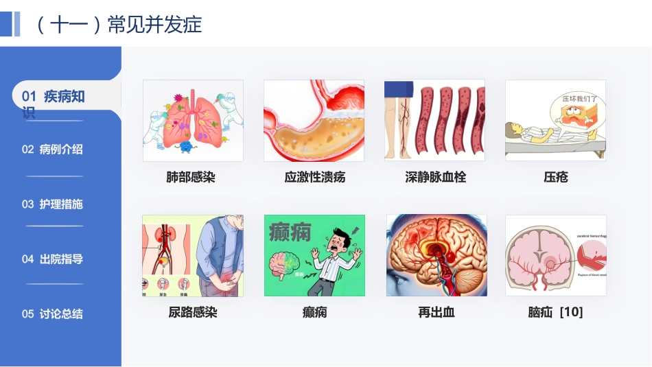 一例脑出血患者的个案护理——基于最新指南的规范化护理实践与效果分析_第12页