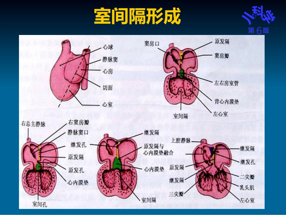 儿科护理学先天性心脏病_第11页