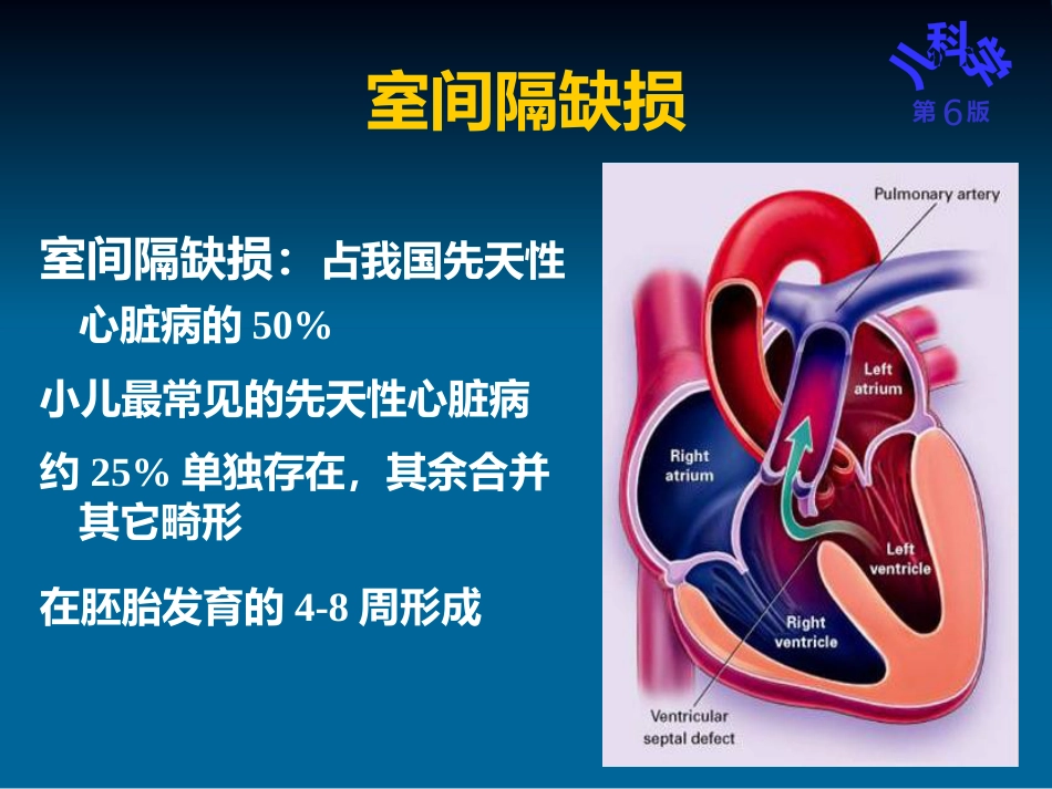 儿科护理学先天性心脏病_第13页