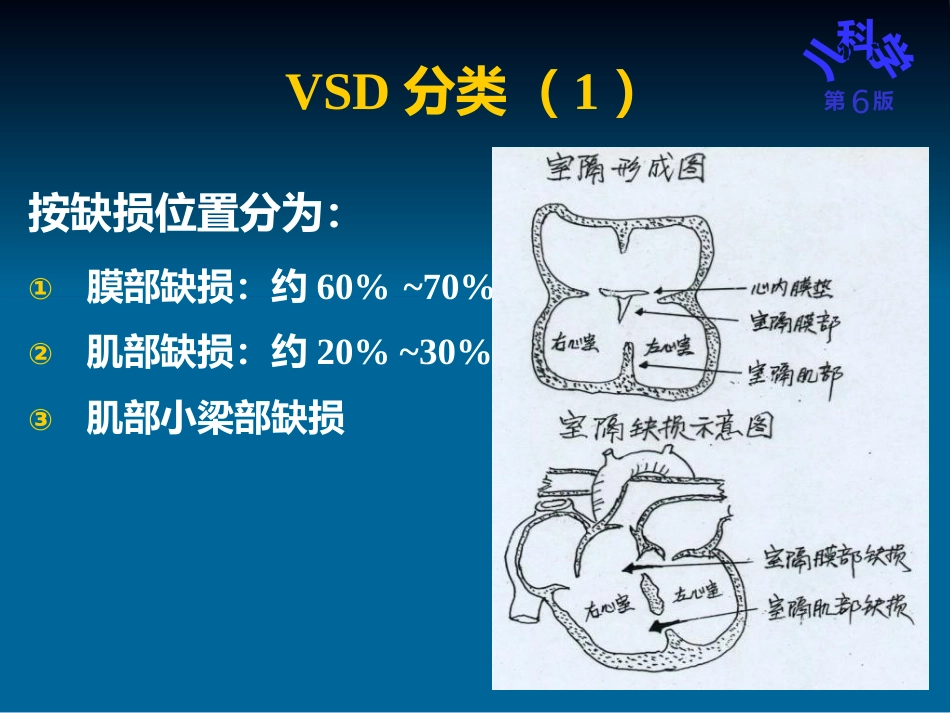 儿科护理学先天性心脏病_第14页
