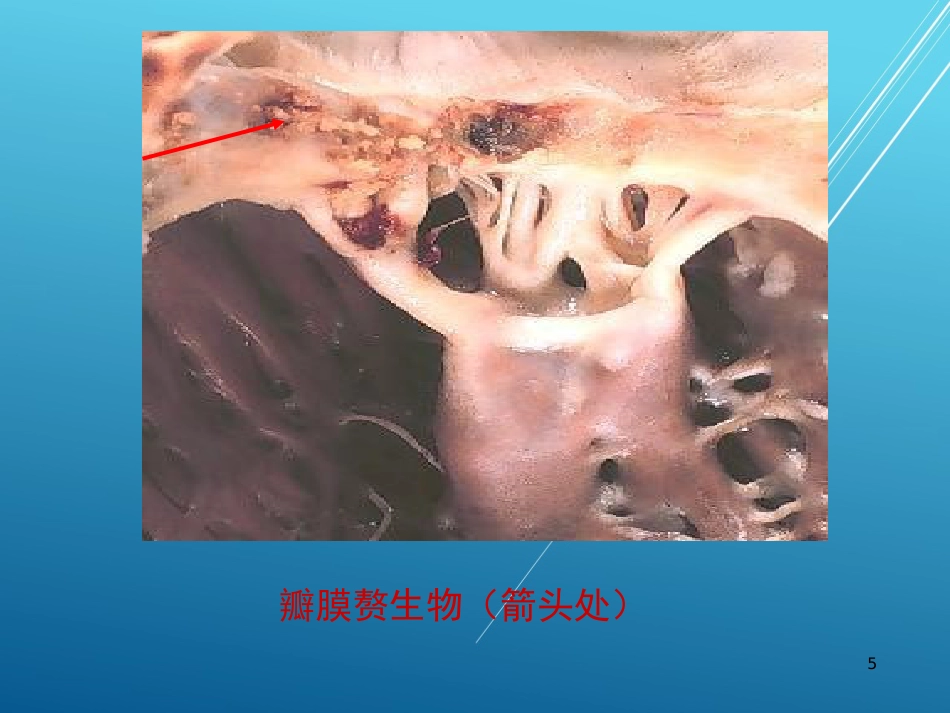 儿科护理学结缔组织疾病PPT课件_第5页