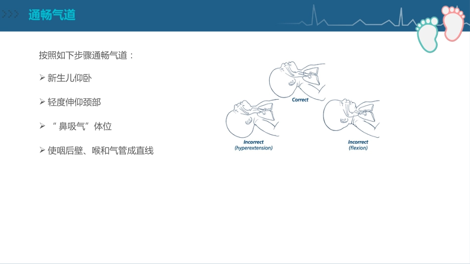 儿科护理：新生儿复苏CPR护理PPT_第15页