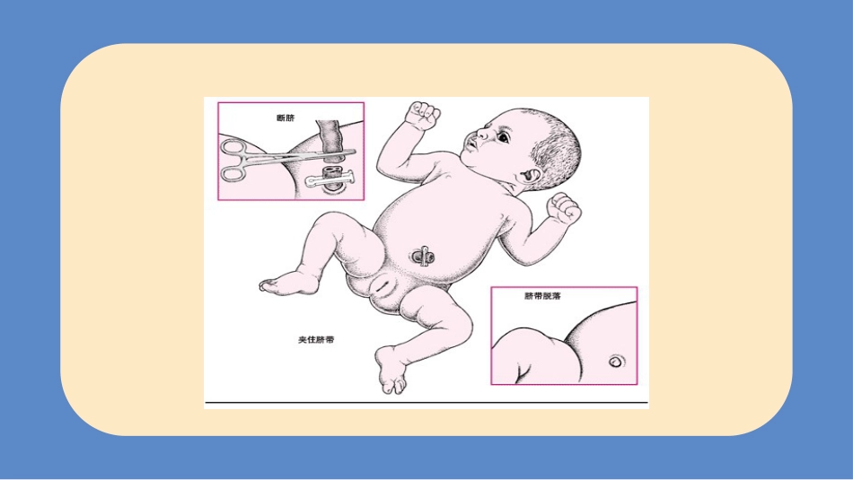 儿科护理：新生儿脐部护理_第8页