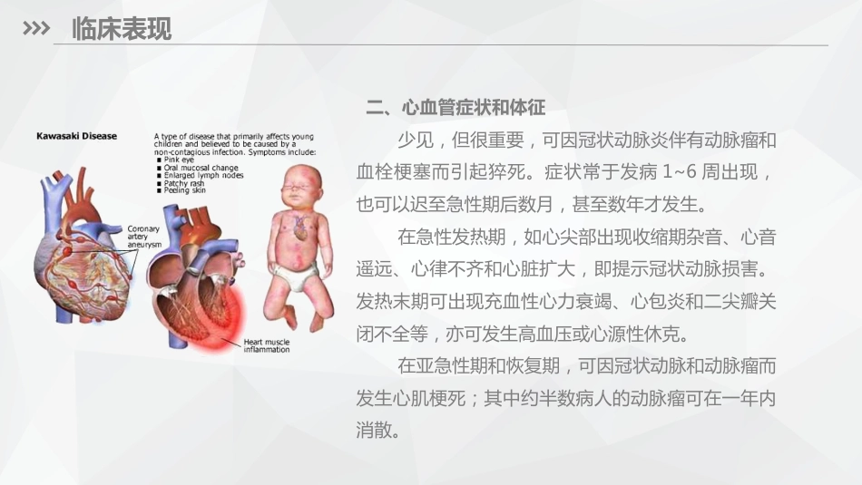 儿科护理：川崎病儿科护理_第13页