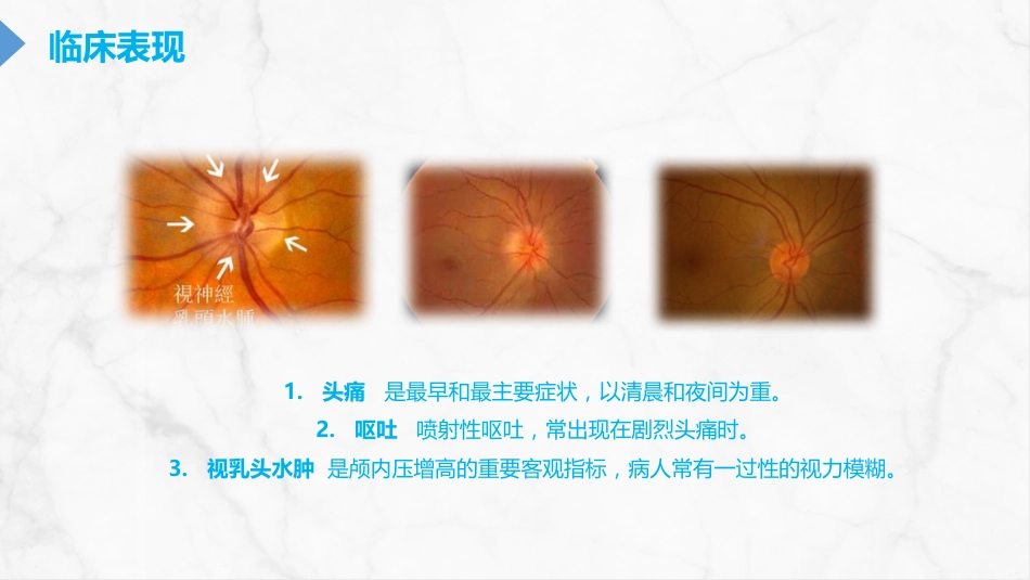重症护理：颅内压增高的护理PPT_第7页
