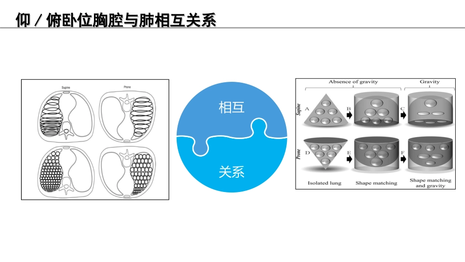俯卧位通气的护理课件_第10页