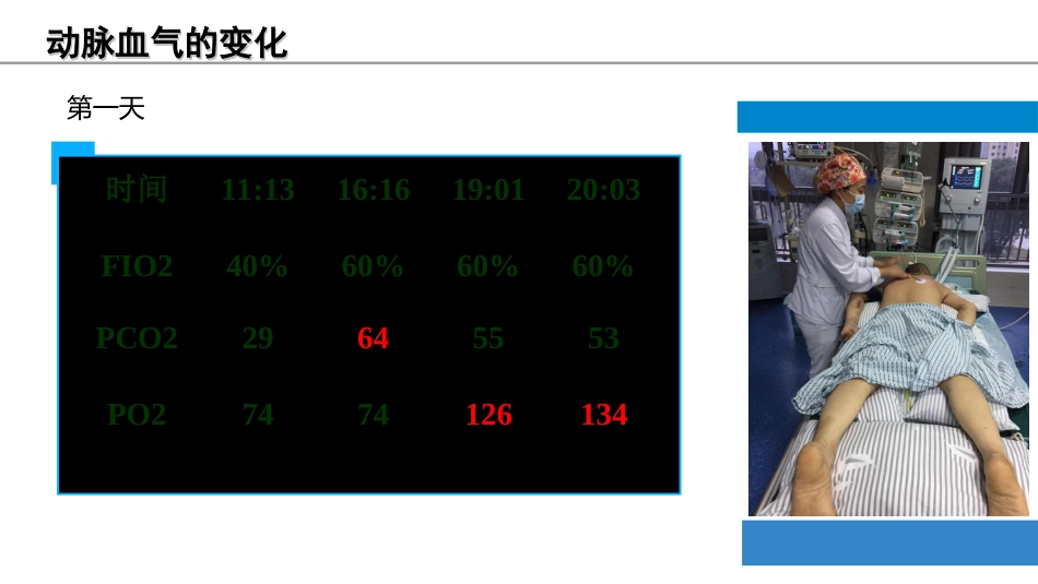 俯卧位通气的护理课件_第12页