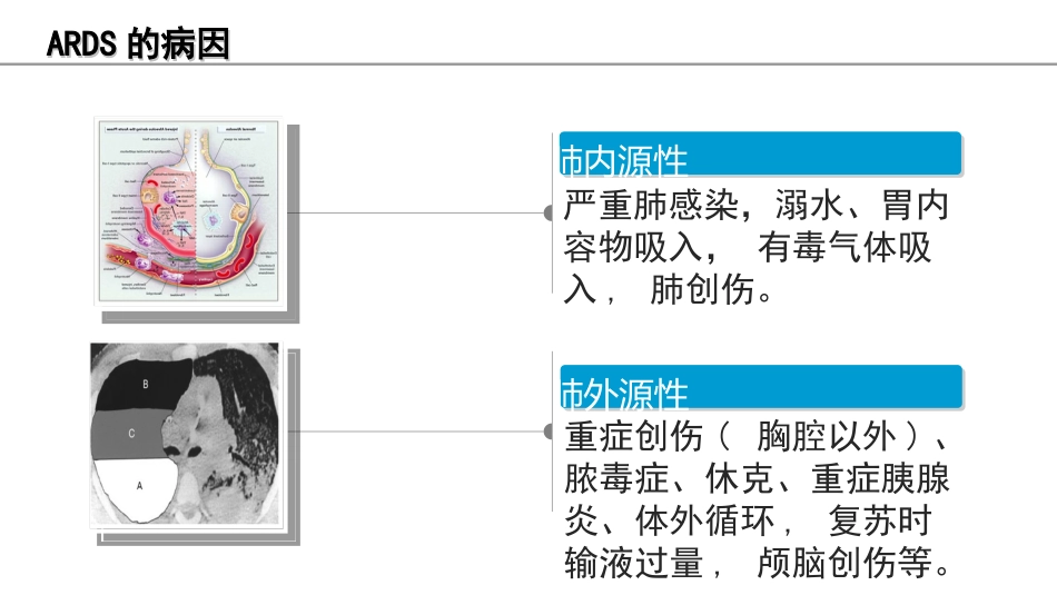 俯卧位通气的护理课件_第4页