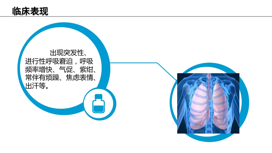 俯卧位通气的护理课件_第5页
