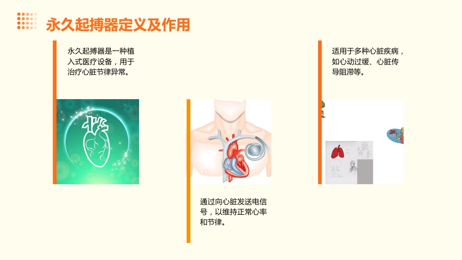 永久起搏器的术后护理ppt课件pptx_第4页