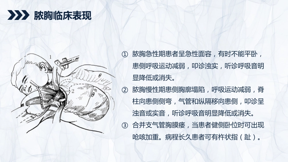 重症护理：贲门癌伴脓胸吻合口瘘护理查房_第11页