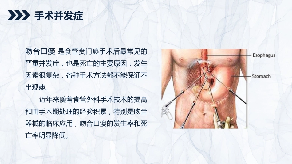 重症护理：贲门癌伴脓胸吻合口瘘护理查房_第12页