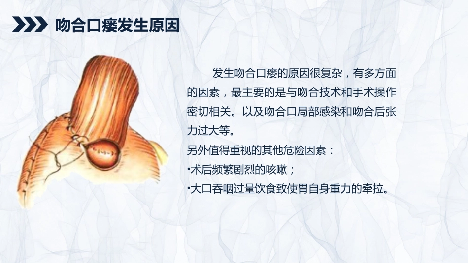 重症护理：贲门癌伴脓胸吻合口瘘护理查房_第13页