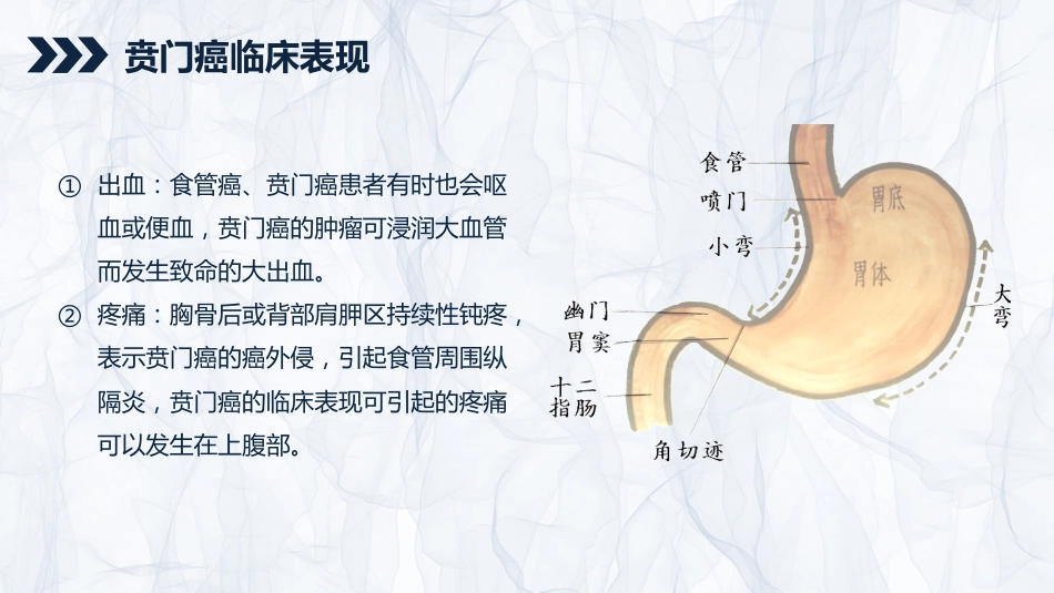 重症护理：贲门癌伴脓胸吻合口瘘护理查房_第7页