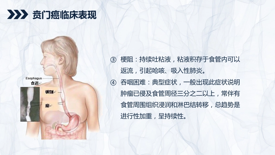 重症护理：贲门癌伴脓胸吻合口瘘护理查房_第8页