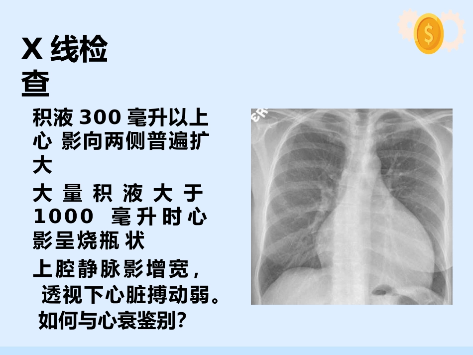 心脏压塞、肺栓塞、血管迷走反射的紧急处理与护理配合_第13页