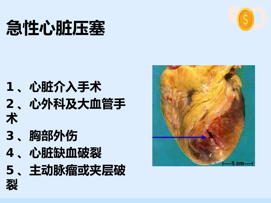 心脏压塞、肺栓塞、血管迷走反射的紧急处理与护理配合_第8页