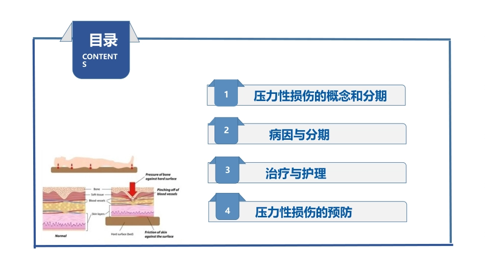 压力性损伤预防及护理_第2页