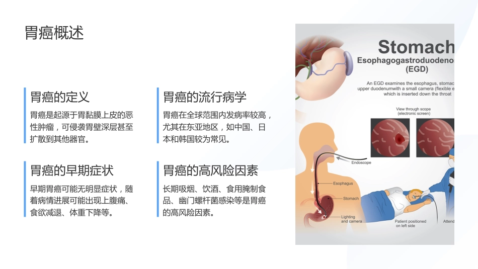 胃癌的护理查房ppt_第4页