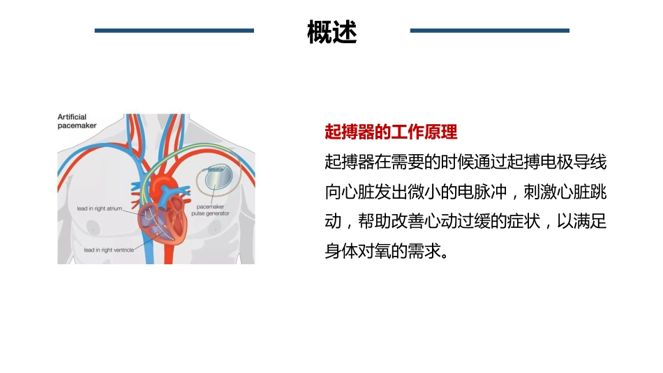 心脏永久起搏器植入术后的护理_第5页