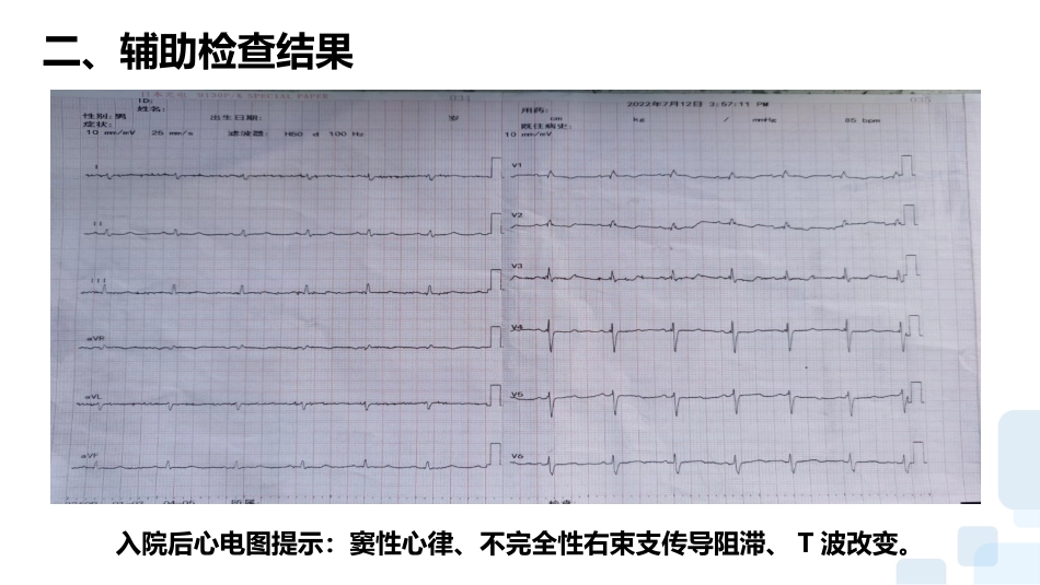 一例心力衰竭合并呼吸衰竭患者的护理查房_第7页