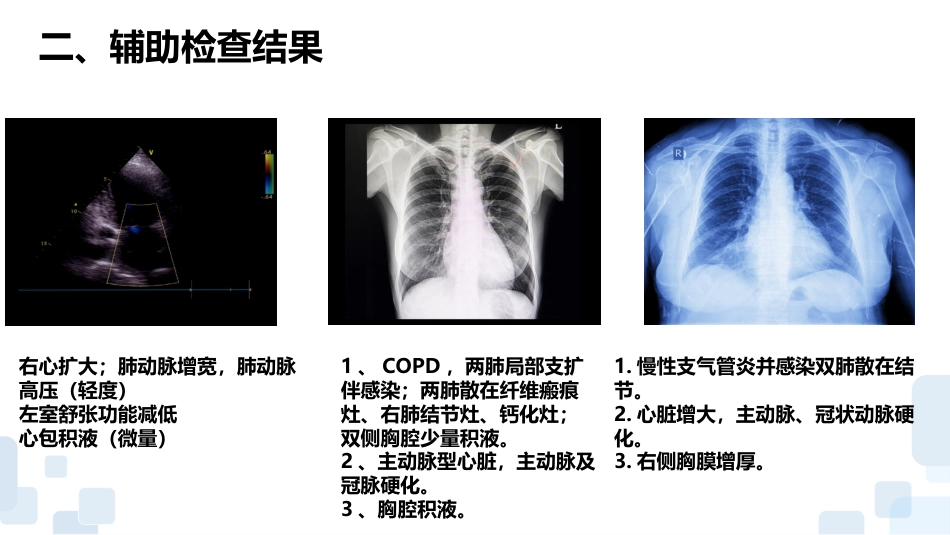 一例心力衰竭合并呼吸衰竭患者的护理查房_第8页