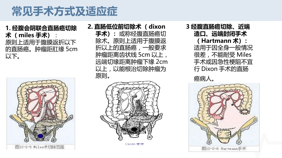 腹腔镜下直肠癌根治术疾病护理查房_第15页