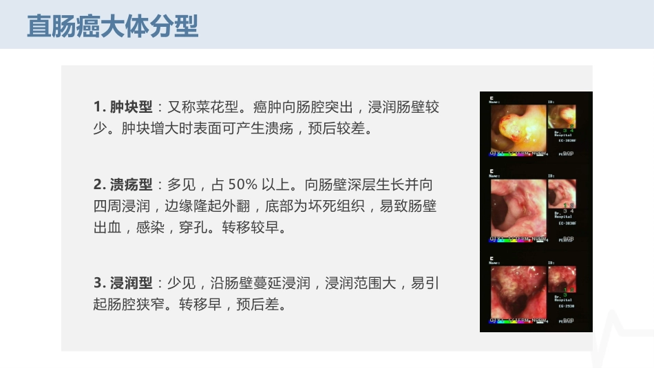 腹腔镜下直肠癌根治术疾病护理查房_第9页