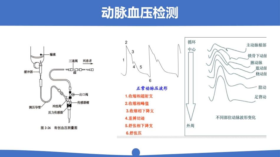 脓毒血症病人护理详解PPT_第15页