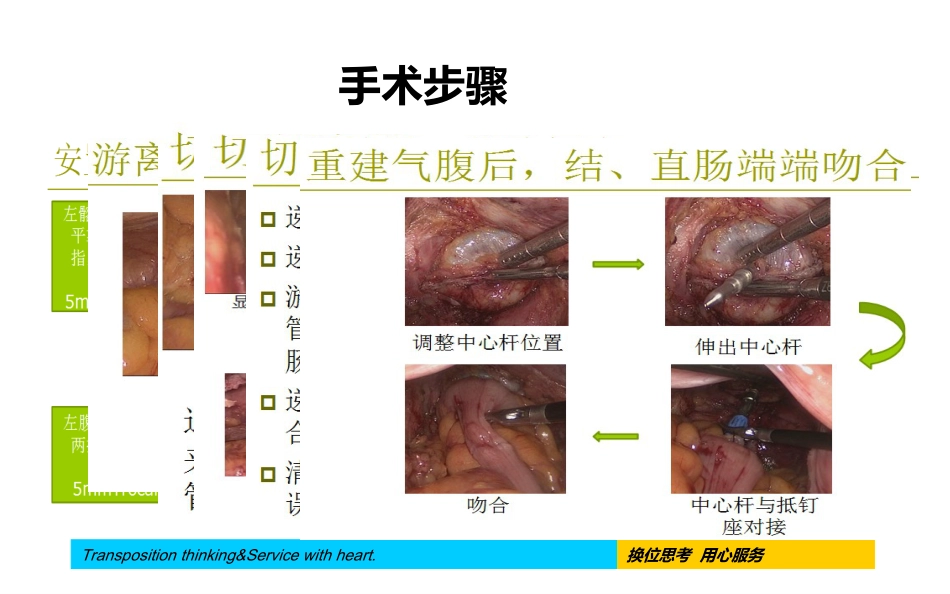 腹腔镜下直肠癌根治术手术配合及护理疾病查房_第15页