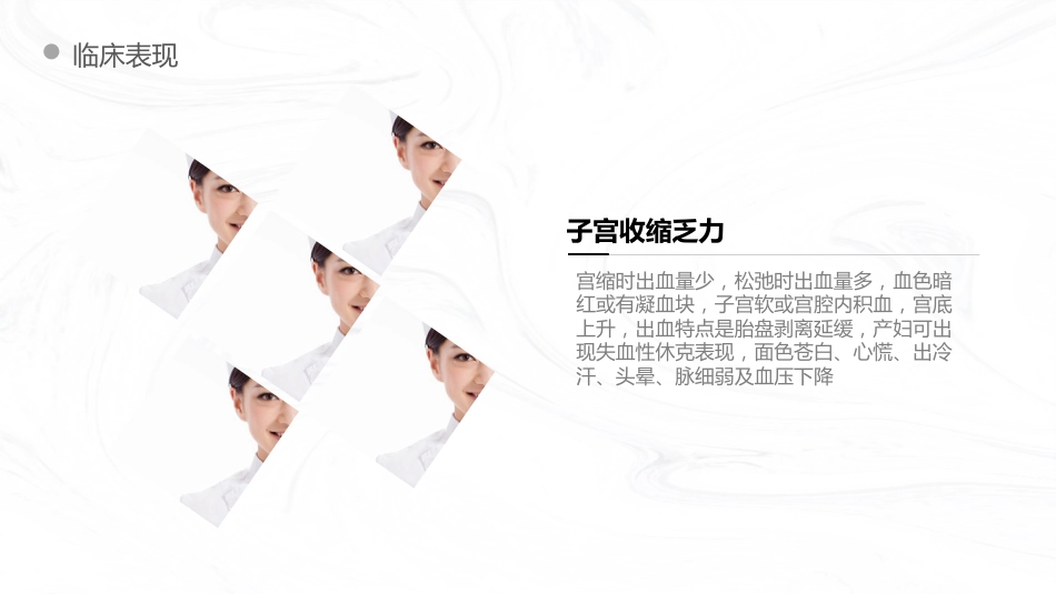重症护理：产后出血护理查房_第8页