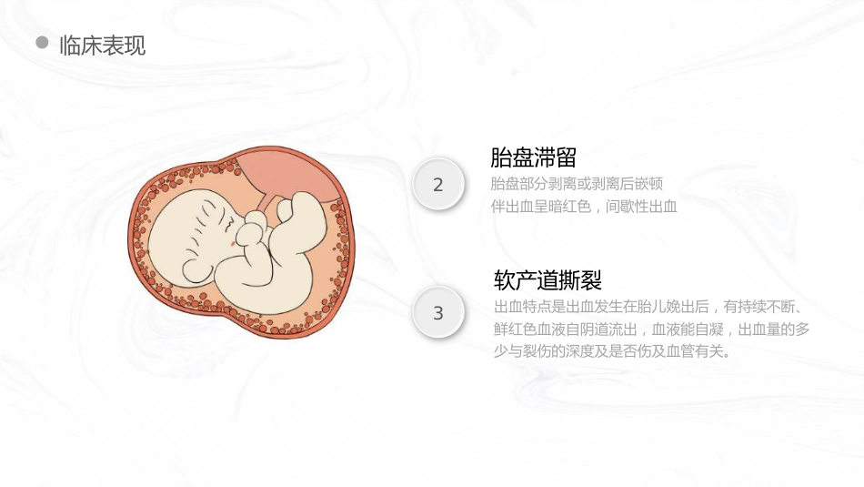 重症护理：产后出血护理查房_第9页