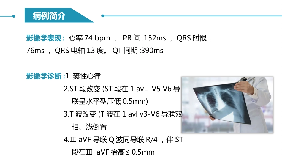 阵发性室上性心动过速护理查房_第12页
