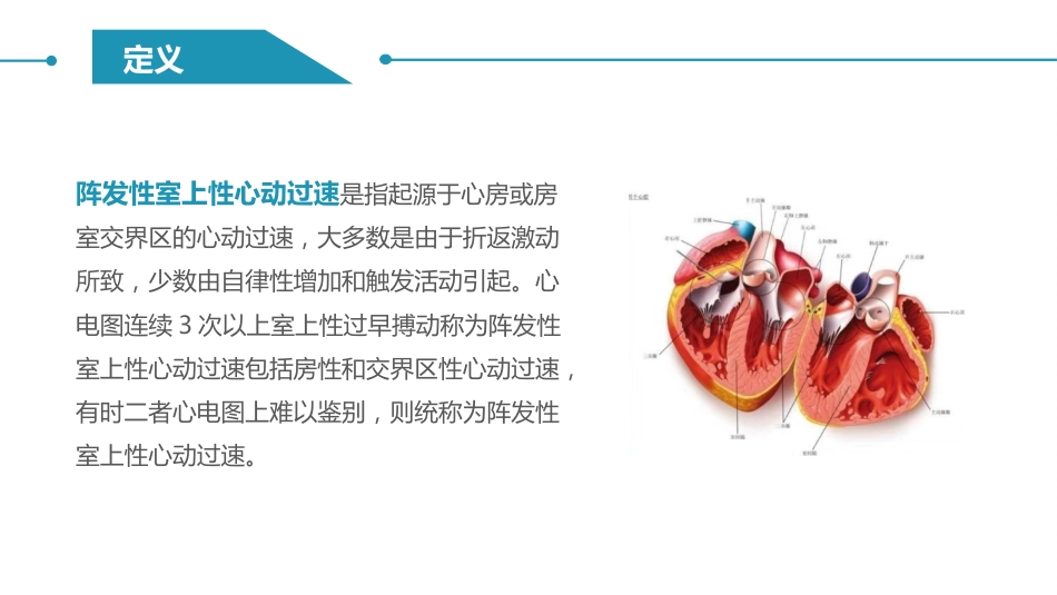阵发性室上性心动过速护理查房_第4页