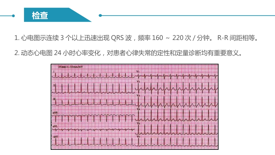 阵发性室上性心动过速护理查房_第7页