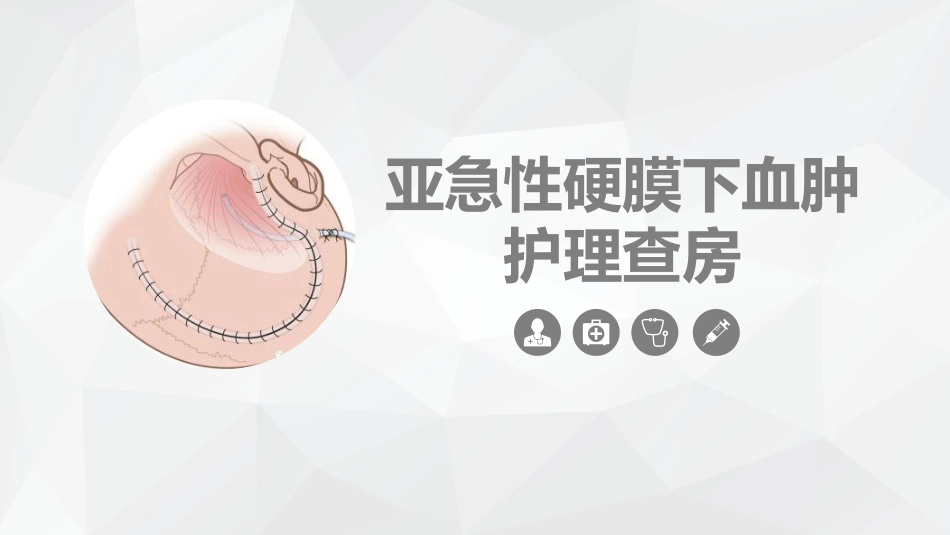 重症护理：亚急性硬膜下血肿护理查房_第1页