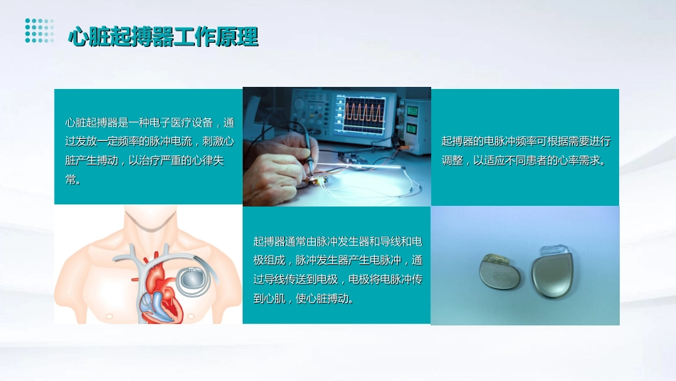 心脏起搏器植入术围术期护理PPT课件_第7页
